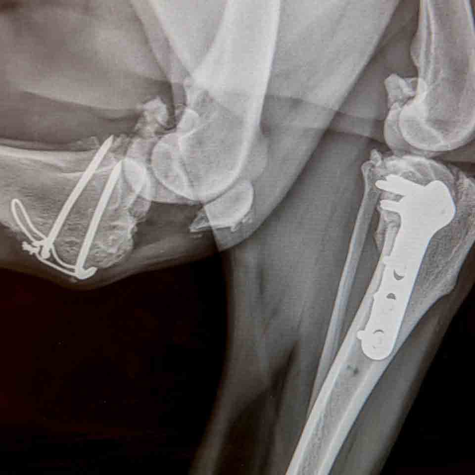x-ray