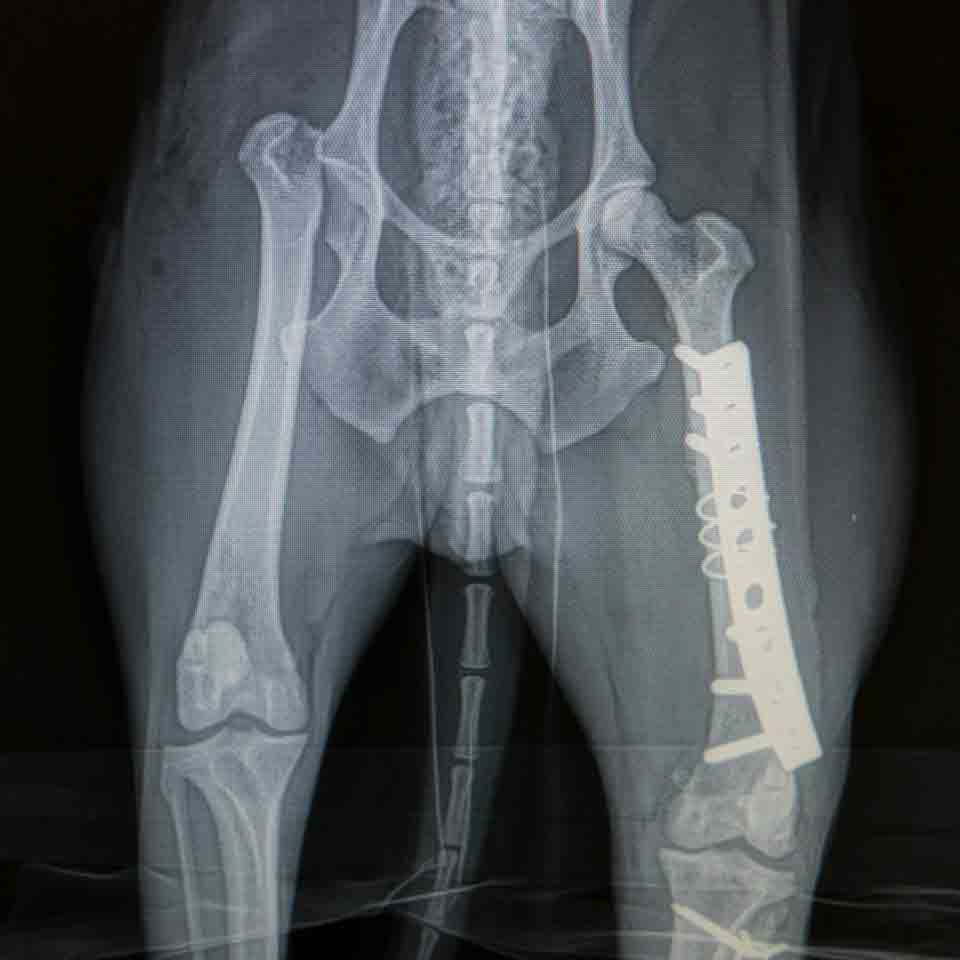 orthopedic x-ray